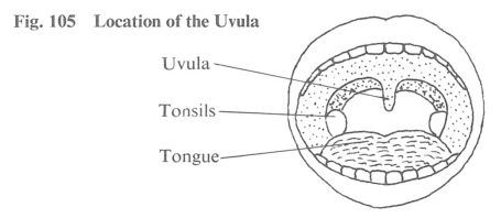 Fig. 105 Location of the Uvula